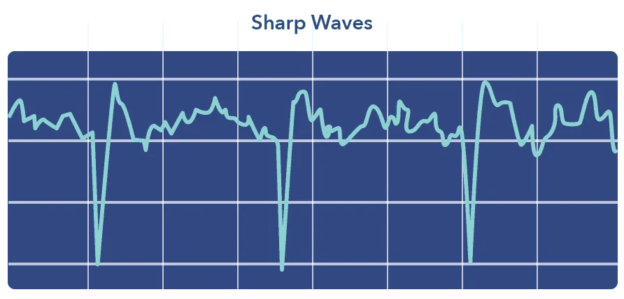 SO N3SleepGraphics Waves