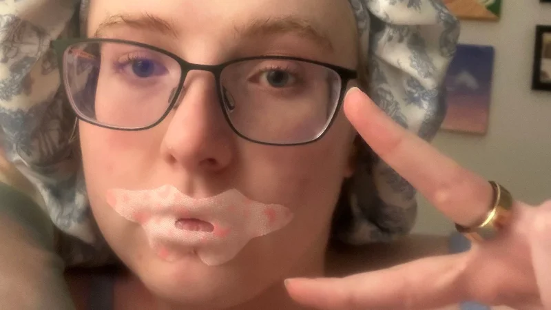 Livvi poses with a mouth tape patch