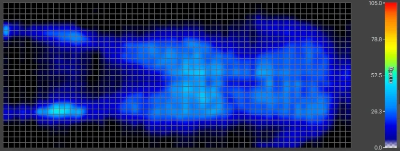 Pressure map of a heavier back-sleeper on a Saatva Latex Hybrid.