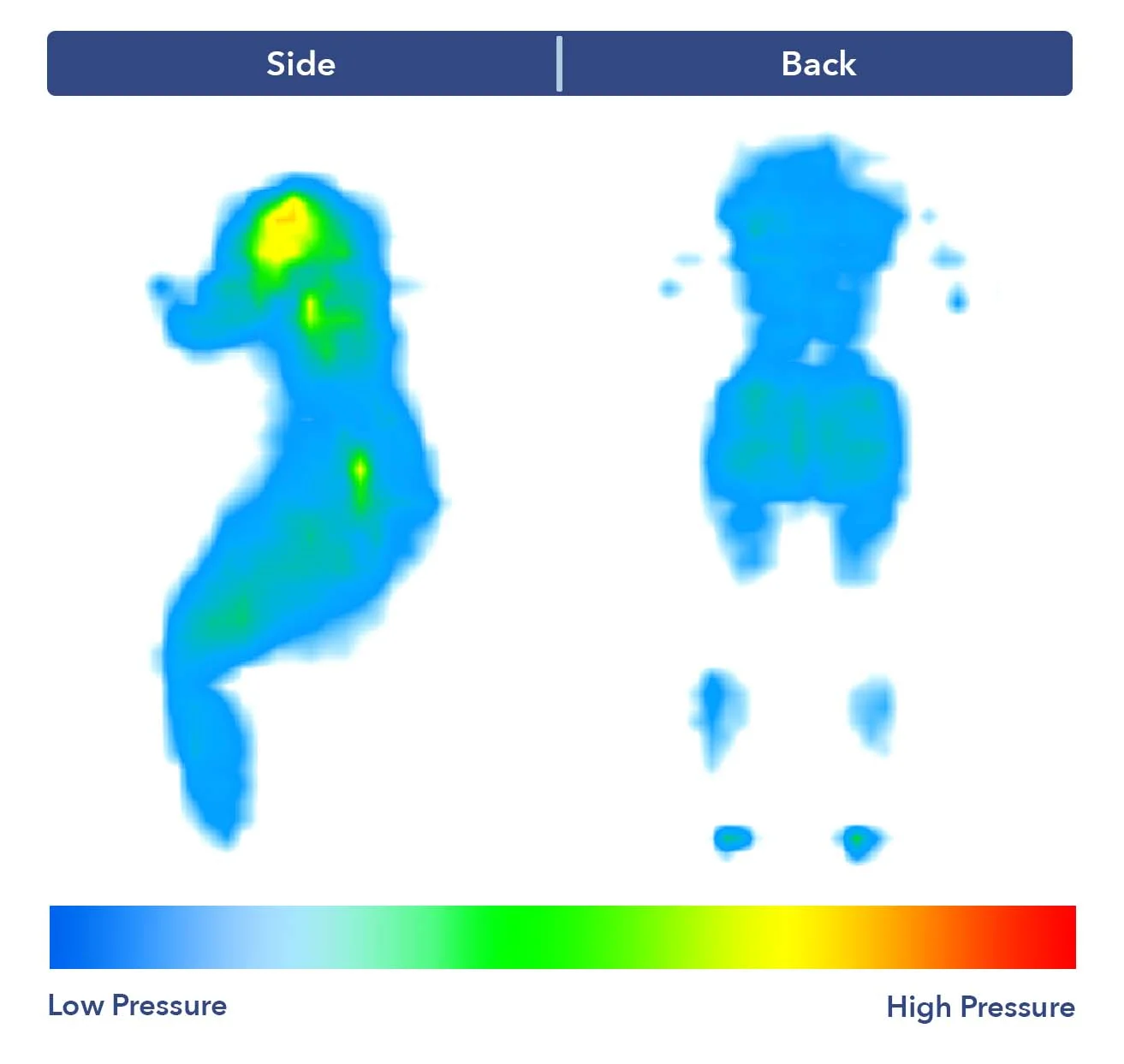 PressureMap_HelixPlus