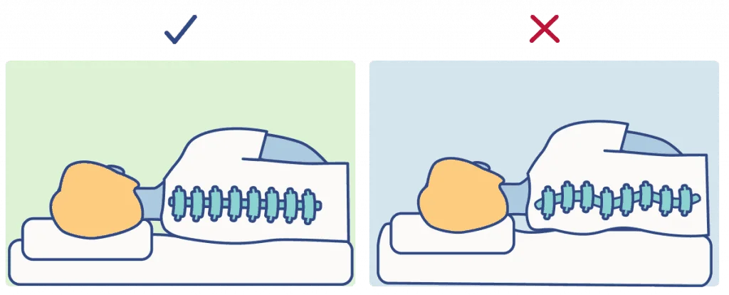 SO BackPainGraphics Alignment