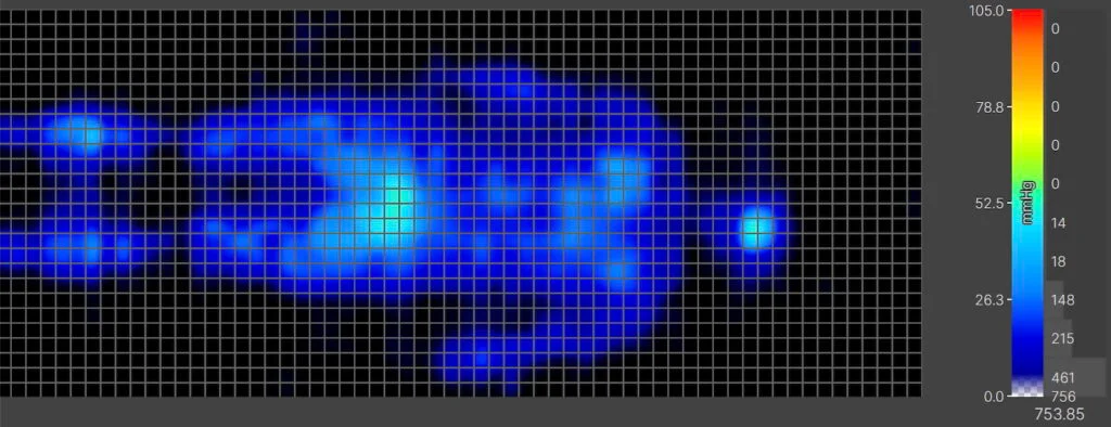 CopperFlex Average Back
