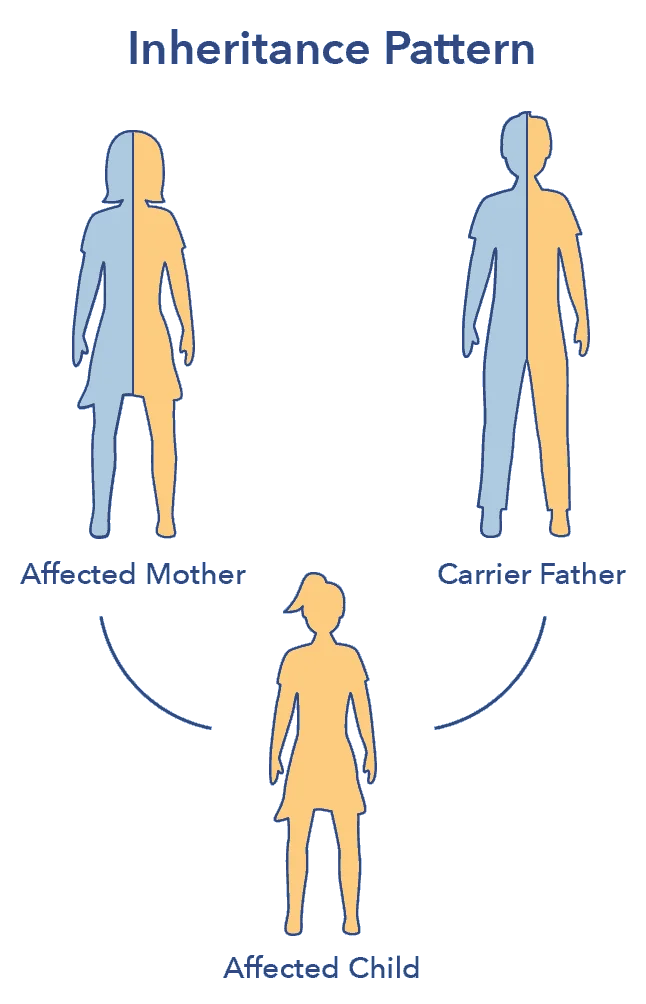 SO SleepEdu Inheritance