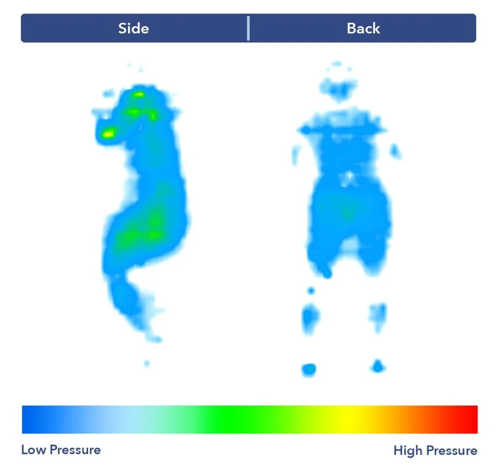 PressureMap SaatvaHD