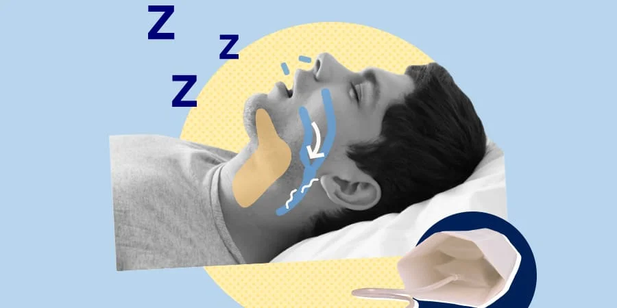 Smart Nora Anti-Snore Review