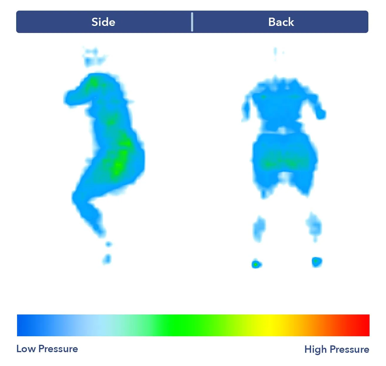 PressureMap DouglasAlpine