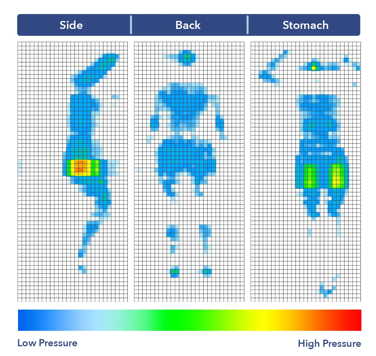 SaatvaClassicPressure