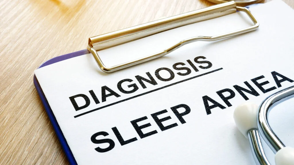 InspireImplantForSleepApnea 1