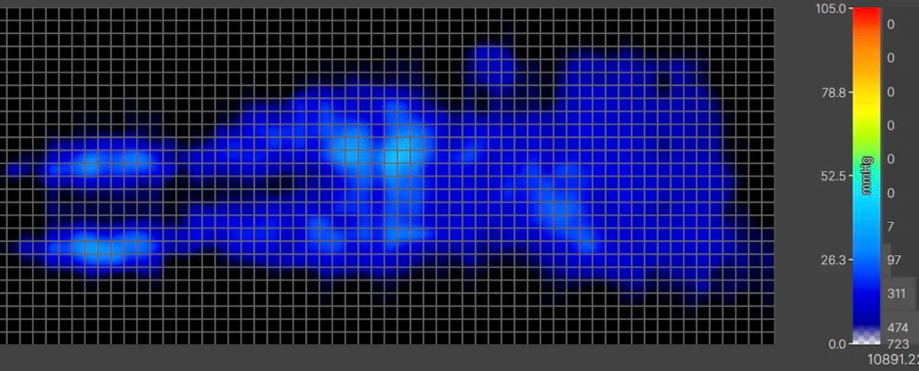 Our pressure map for the Saatva. It shows a thermal graphic of an average-weight sleeper lying on their back. The map is mostly blue, indicating low pressure buildup.