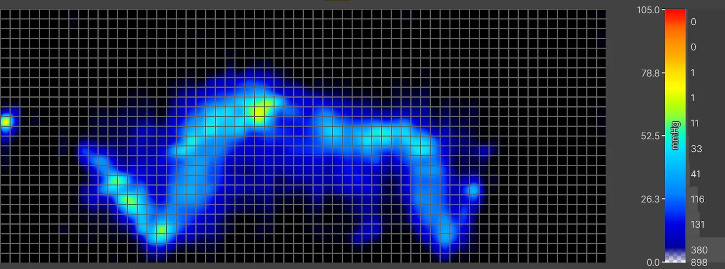 A thermal graphic displaying an average-weight sleeper lying on their side. The graphic is mostly blue, indicating low pressure buildup. That said, there's some yellow at the hips, indicating moderate pressure buildup in this area of the body.