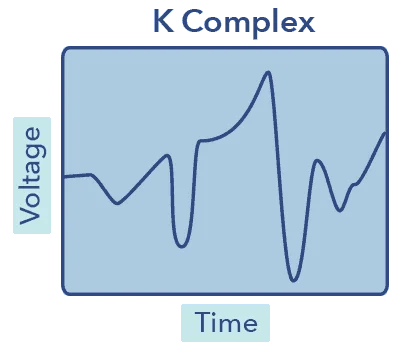 SO SleepStagesGraphics2 K Complex