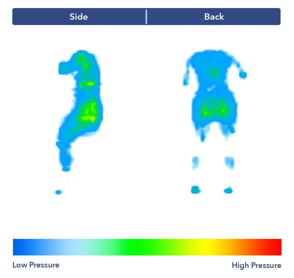 PressureMap Tuft NeedleHybrid