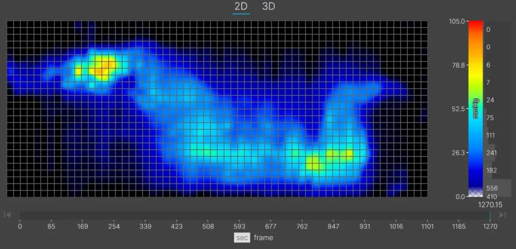 A thermal graphic showing a larger-bodied mattress tester resting on the WinkBed in the side-sleeping position. There's a flareup of yellow at the shoulder, indicating some moderate pressure buildup.