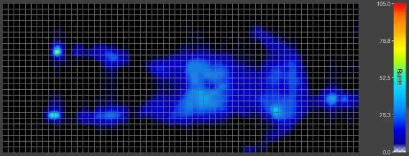 Pressure map of a lightweight back-sleeper on a Saatva Latex Hybrid.