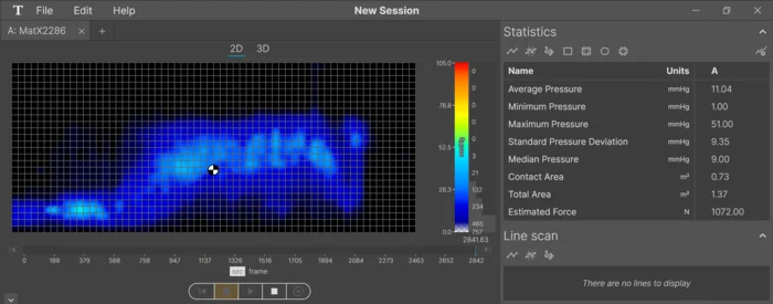 2 4 helix moonlight SO average side