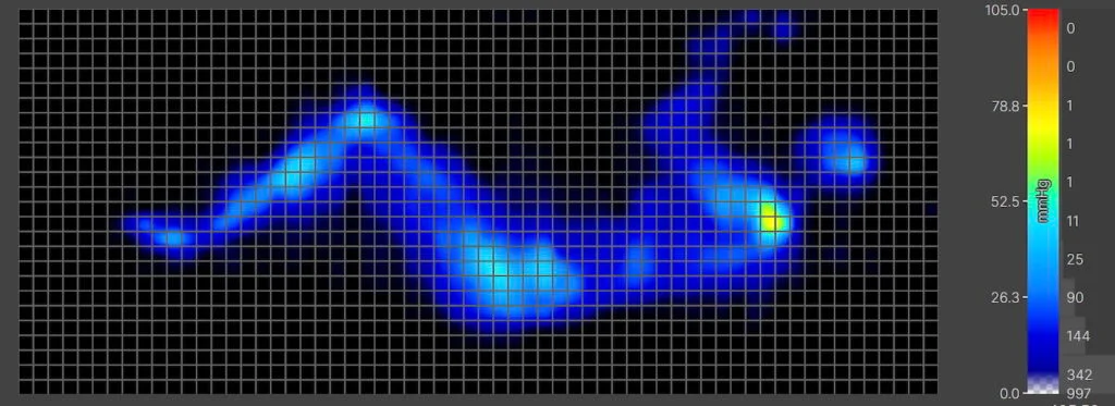 CopperFlex Light Side