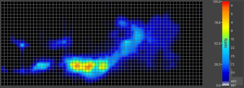 Pressure map of our lightweight tester side-sleeping on a Helix Midnight Luxe mattress.